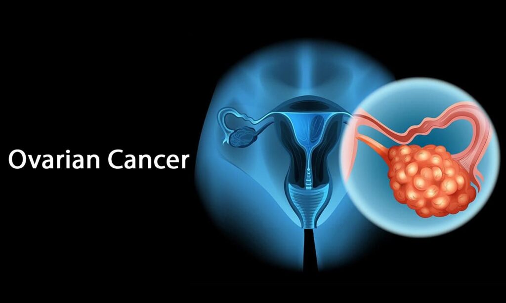 जागतिक कॅन्सर दिन (Types of Cancer)